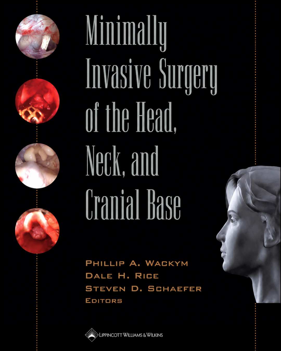 Couverture du livre Minimally Invasive Surgery of the Head, Neck, and Cranial Base