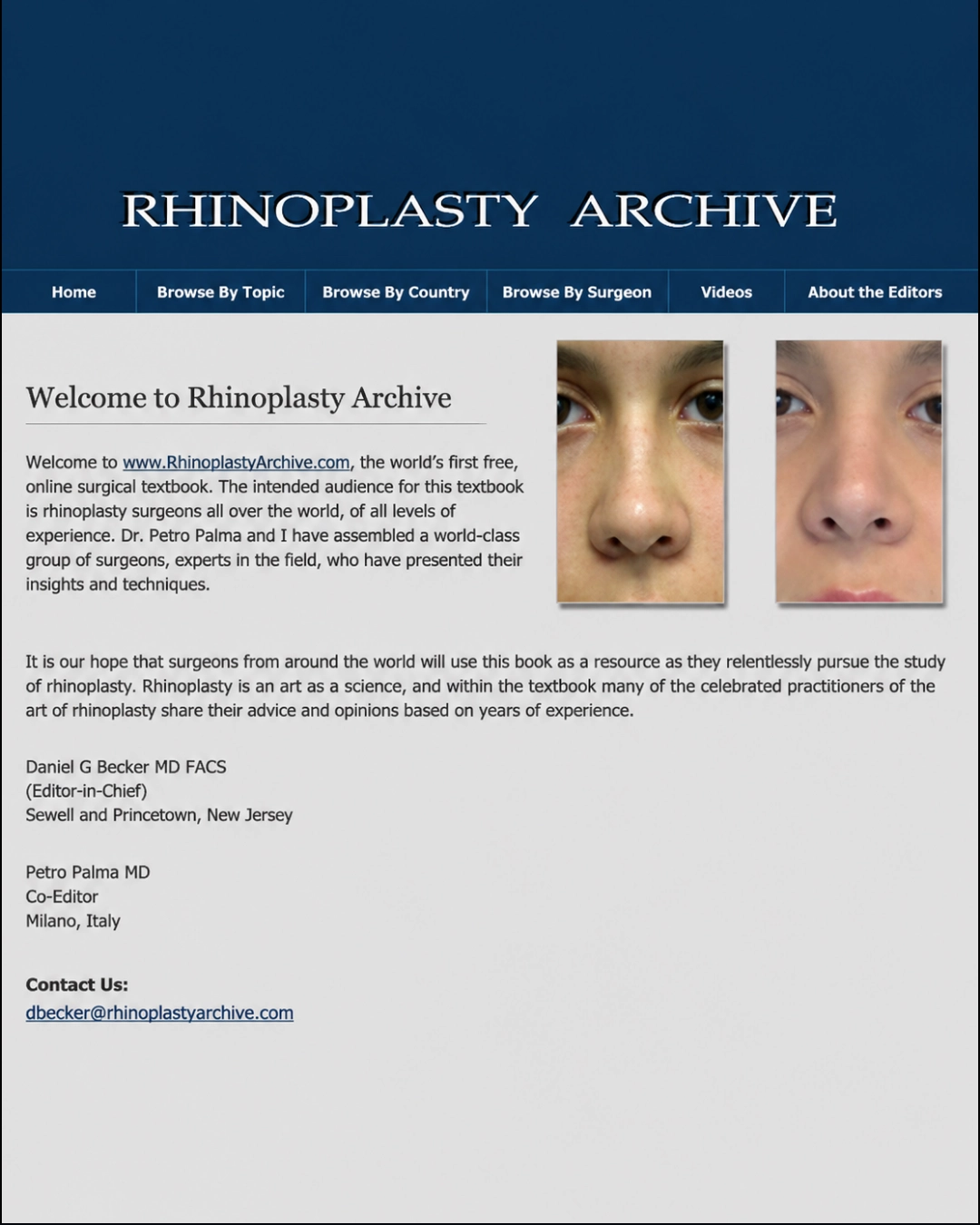 Capture d'écran du site Rhinoplasty Archive