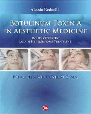 Couverture du livre Botulinum Toxin A in Aesthetic Medicine